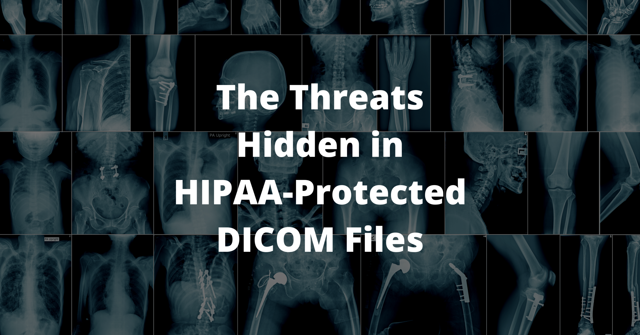 Image of multiple x-rays with text overlayed promoting a Votiro article about hidden threats in HIPAA-Protected DICOM files - Votiro